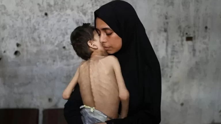 Leia mais sobre o artigo “Arma de guerra”, fome atinge meio milhão de palestinos