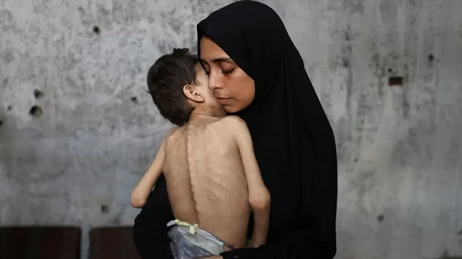 Leia mais sobre o artigo “Arma de guerra”, fome atinge meio milhão de palestinos