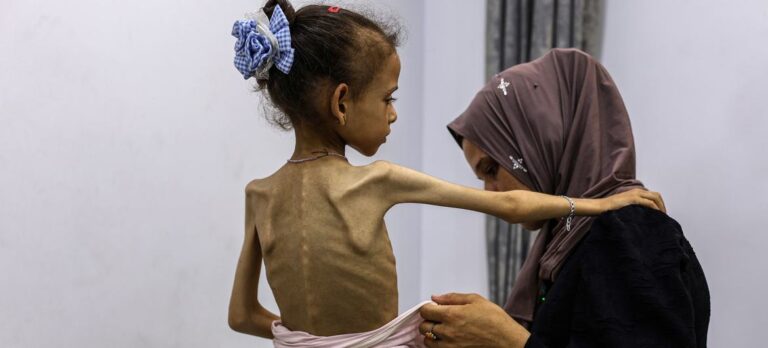 Leia mais sobre o artigo What Does It Mean to Declare Famine in Gaza?